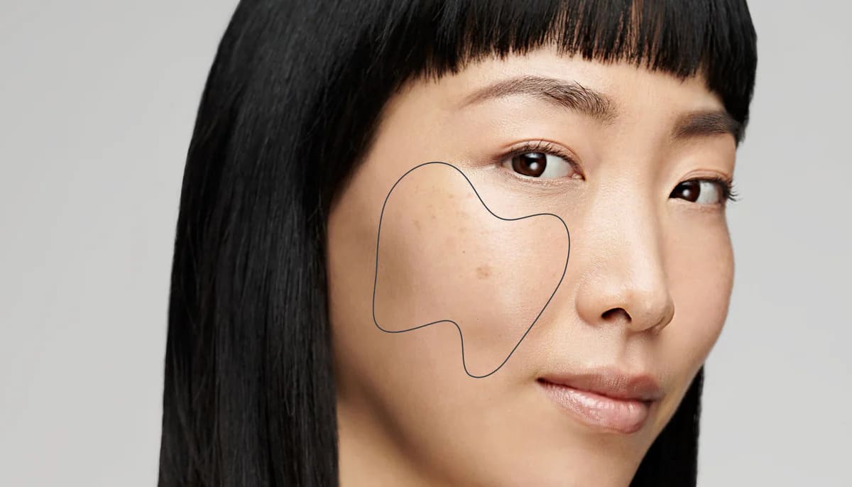 Cách cải thiện làn da không đều màu đơn giản
